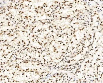 DBC1 Antibody - image 1