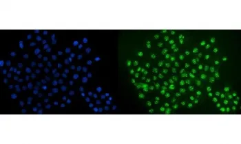 ERG Antibody / Transcriptional regulator ERG - image 1
