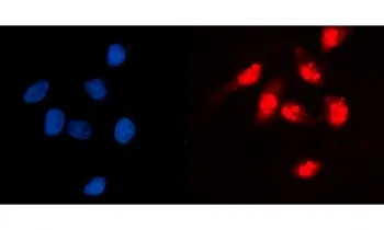 GCKR Antibody / Glucokinase Regulator - image 1