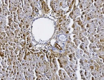 Alanine aminotransferase 1 Antibody - image 1