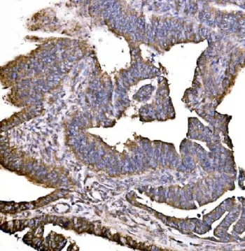 HIP1R Antibody / Huntingtin-interacting protein 1-related protein - image 1