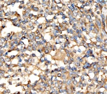 AP2A2 Antibody / AP-2 complex subunit alpha-2 - image 1