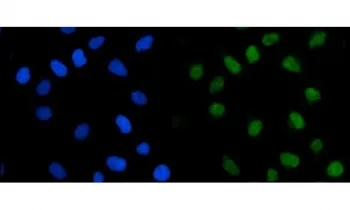 TRMT1 Antibody - image 1