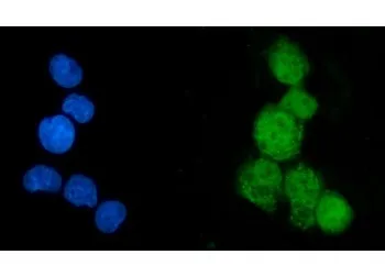 EEF2K Antibody / Eukaryotic elongation factor 2 kinase - image 1