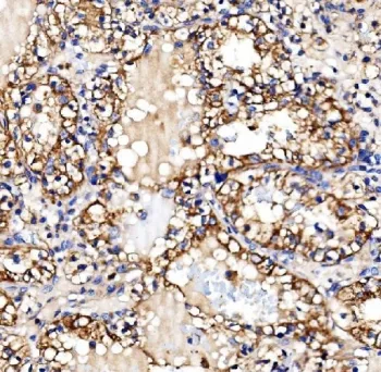 Glycogen synthase 1 Antibody / GYS1 - image 1