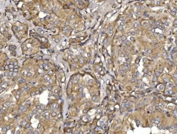 MEFV Antibody / Marenostrin / Pyrin - image 1