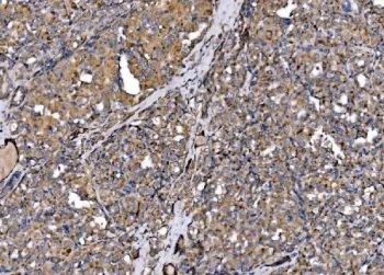 MLXIP Antibody / MLX-interacting protein - image 1