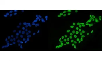 SF1 Antibody / Splicing factor 1 - image 1