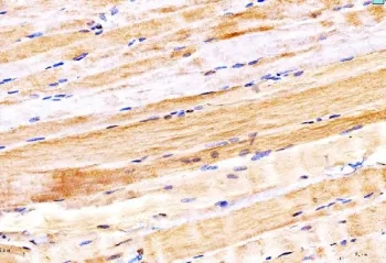MYH6 Antibody / Myosin 6 - image 1