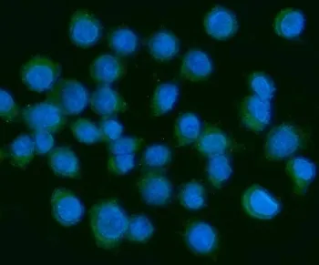 PDGFA Antibody / Platelet Derived Growth Factor A / PDGF AA - image 1
