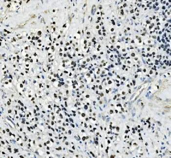 TFAP2C Antibody / AP2 gamma - image 1