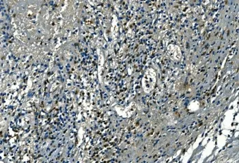 Azurocidin Antibody / AZU1 / CAP37 - image 1