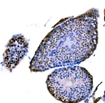 DMC1 Antibody - image 1