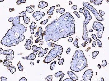 LNPEP Antibody / OTase - image 1