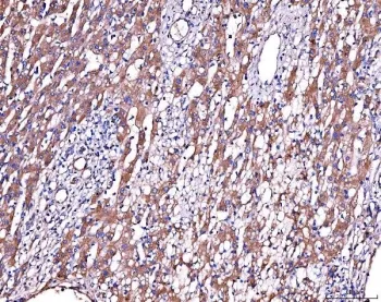 Alpha-2-Antiplasmin Antibody / SERPINF2 - image 1