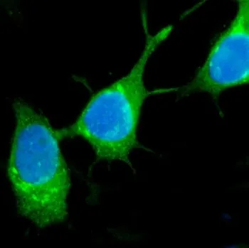 Estrogen Inducible Protein pS2 / TFF1 Antibody - image 1