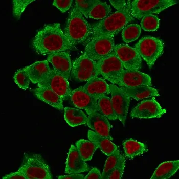 Alpha Actin Antibody / ACTA2 (smooth muscle) - image 1