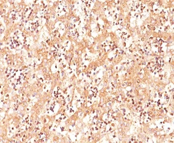 Alpha Fetoprotein / AFP Antibody - image 1