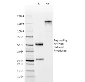 C4d / Complement 4d Antibody - image 1