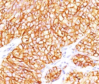 CA9 Antibody / Carbonic Anhydrase IX - image 1