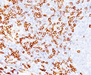 CD8A Antibody - image 1