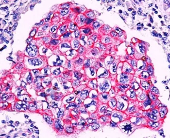 Beta Catenin Antibody - image 1