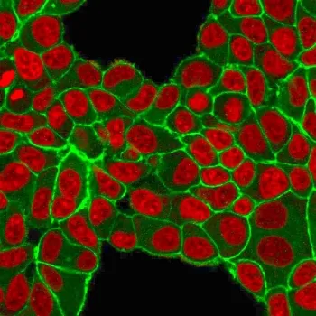 HER2 Antibody / ErbB2 - image 1