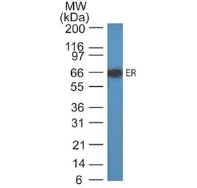 Estrogen Receptor alpha Antibody - image 1
