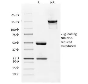 VEGF Receptor 1 / VEGFR1 Antibody / FLT1 - image 1