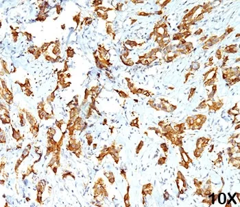 HSP27 Antibody / HSPB1 - image 1