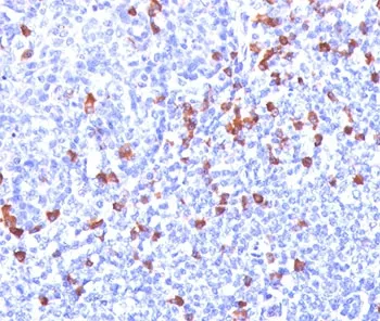 Kappa Light Chain Antibody - image 1