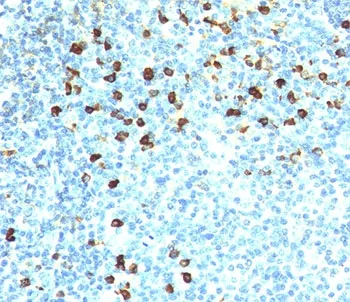 Kappa Light Chain Antibody - image 1