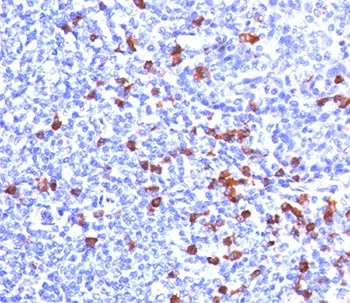Kappa Light Chain Antibody - image 1