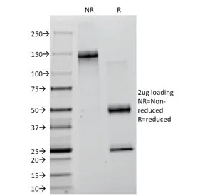 Lambda Light Chain Antibody / Lambda Antibody - image 1