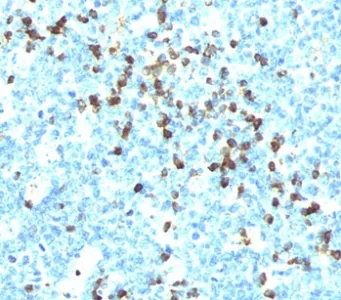 Lambda Light Chain Antibody / Lambda Antibody - image 1