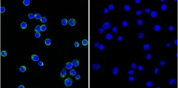 Lambda Light Chain Antibody / Lambda Antibody - image 1