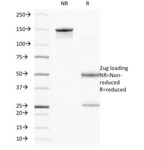 Integrin beta 4 Antibody / ITGB4 / CD104 - image 1