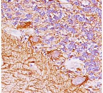 Neurofilament Antibody (-Heavy) / NF-H / NEFH - image 1
