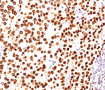 Progesterone Receptor Antibody - image 1
