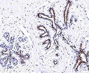 Progesterone Receptor Antibody - image 1