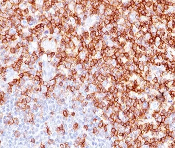 CD45RO Antibody (T-cell marker) - image 1
