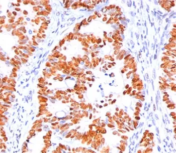 p53 Antibody / TP53 (N-Terminal Region) - image 1