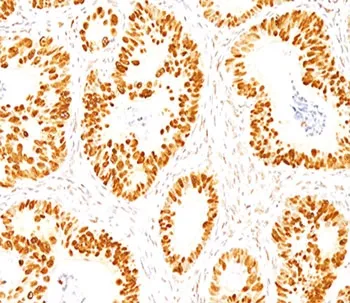 p53 Antibody / TP53 (N-Terminal Region) - image 1