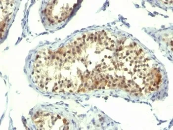 Thymidylate Synthase Antibody - image 1
