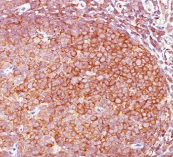 Bcl10 Antibody - image 1