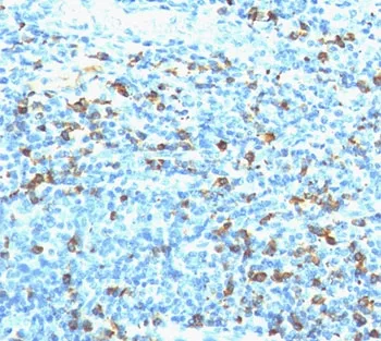 Biotin / Vitamin B7 / Vitamin H Antibody - image 1