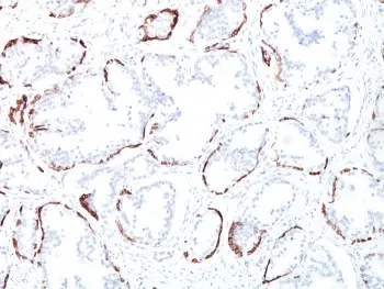 Basic Cytokeratin Antibody (HMW / Type II) - image 1