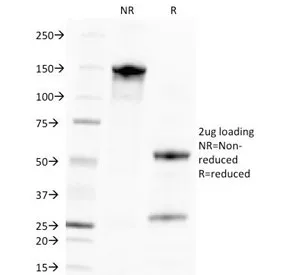 Cytomegalovirus Antibody / CMV / PP65 - image 1