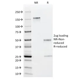 EBV Early Antigens Antibody - image 1
