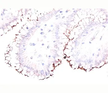 Helicobacter Pylori Antibody - image 1